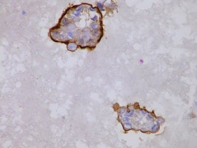 Example Cell block example immunohistochemistry