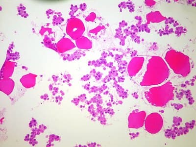 Example Cell block example immunohistochemistry
