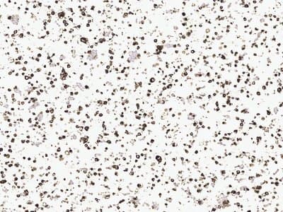 Example Cell pellet immunohistochemistry