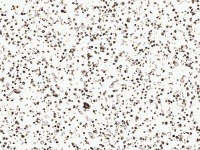 Example Cell pellet immunohistochemistry