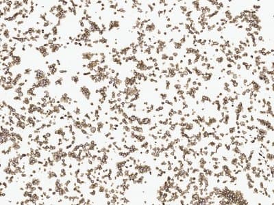Example Cell pellet immunohistochemistry