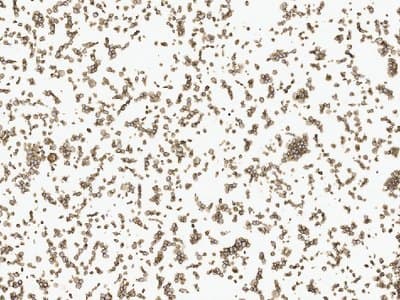 Example Cell pellet immunohistochemistry