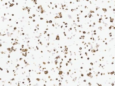 Example Cell pellet immunohistochemistry