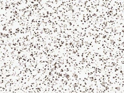 Example Cell pellet immunohistochemistry