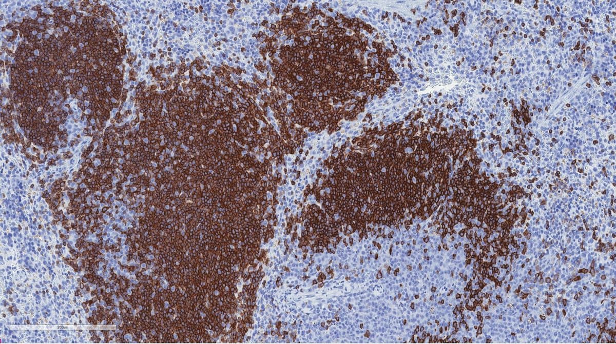 IHC on mouse spleen, lymphoid follicles