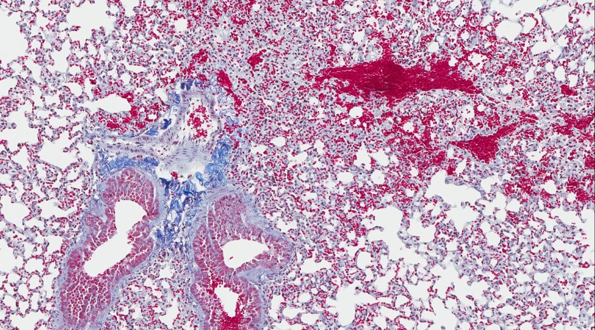 Trichrome on mouse bleomycin-induced fibrotic lung