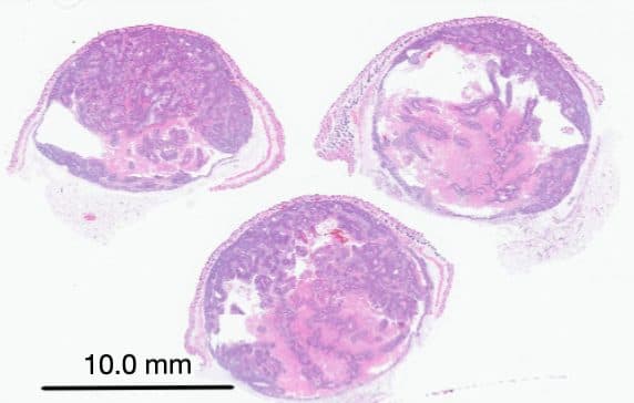 Example H&E image with a pathologist's annotated region outlined