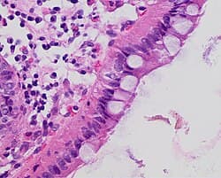 H&E of colon tissue