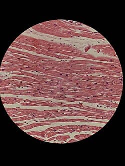 H&E of heart tissue
