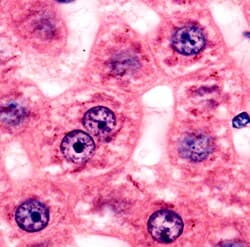 H&E of liver tissue