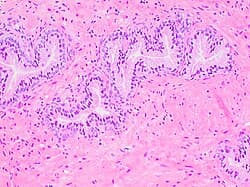 H&E of prostate tissue