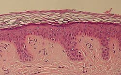 H&E of skin tissue
