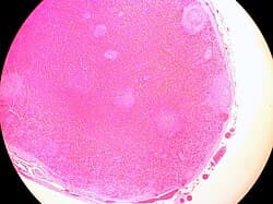 H&E of spleen tissue