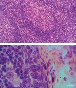 H&E of tonsil tissue